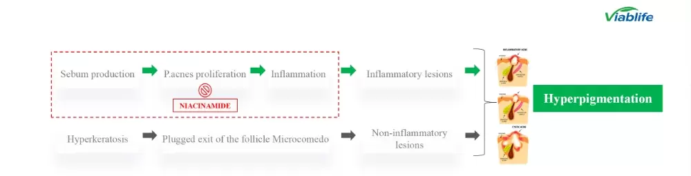 Nicotinamida em cosméticos: controle eficaz da oleosidade e supressão da acne