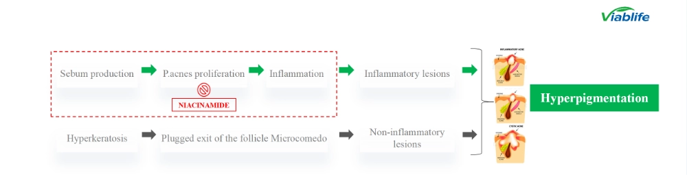 Nicotinamida no tratamento da acne Nicotinamide in Acne Management