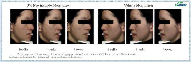 Nicotinamida para clareamento da pele Nicotinamide for Skin Brightening